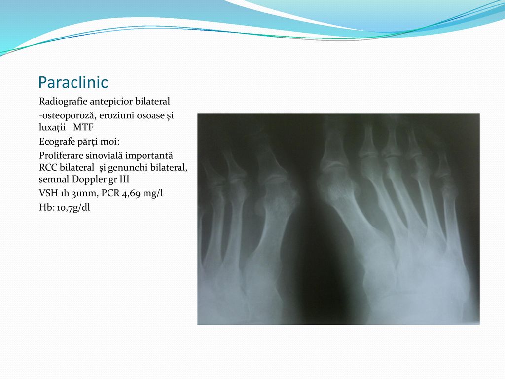 Paraclinic Radiografie antepicior bilateral