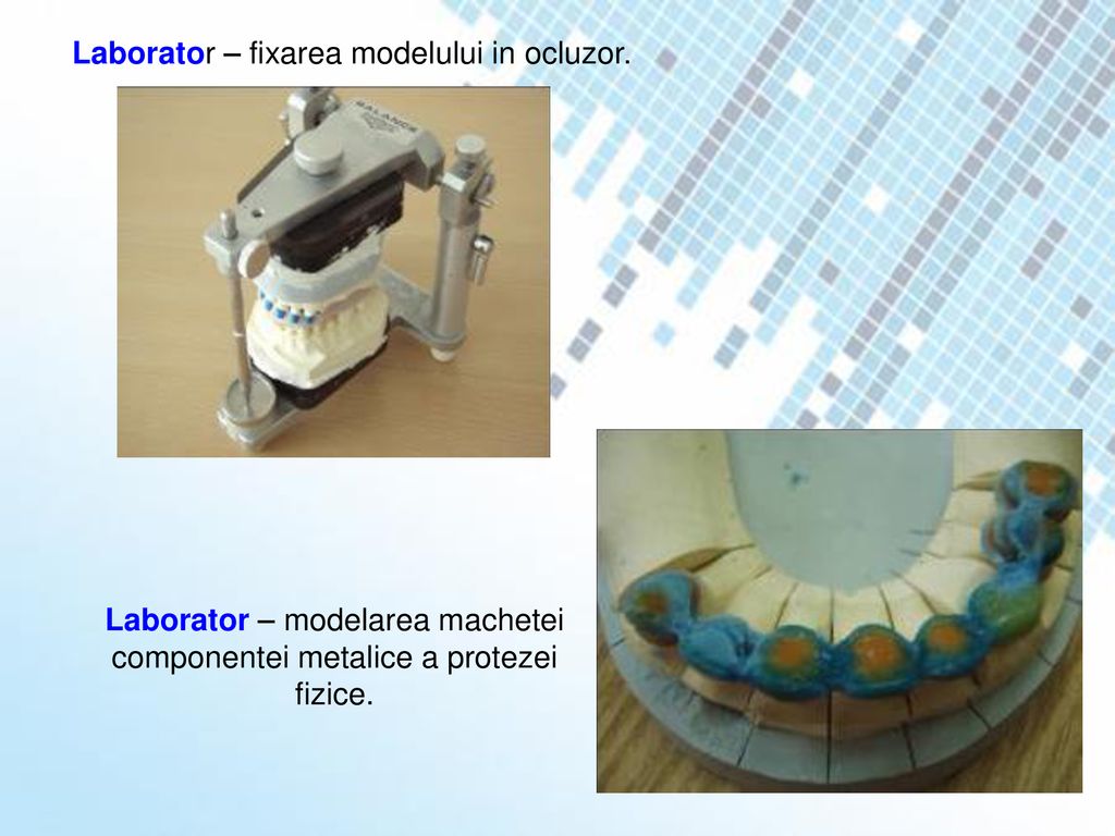 Laborator – modelarea machetei componentei metalice a protezei fizice.