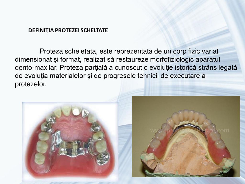 Proteza scheletata, este reprezentata de un corp fizic variat dimensionat şi format, realizat să restaureze morfofiziologic aparatul dento-maxilar.