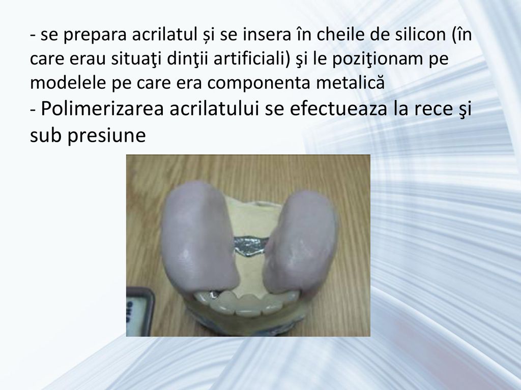 - se prepara acrilatul și se insera în cheile de silicon (în care erau situaţi dinţii artificiali) şi le poziţionam pe modelele pe care era componenta metalică - Polimerizarea acrilatului se efectueaza la rece şi sub presiune
