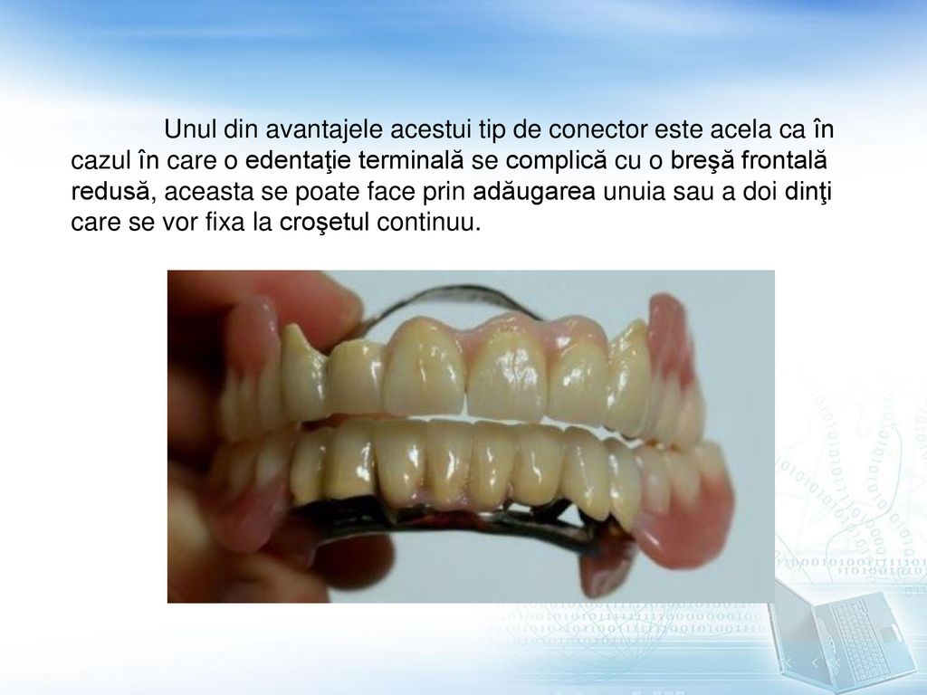 Unul din avantajele acestui tip de conector este acela ca în cazul în care o edentaţie terminală se complică cu o breşă frontală redusă, aceasta se poate face prin adăugarea unuia sau a doi dinţi care se vor fixa la croşetul continuu.
