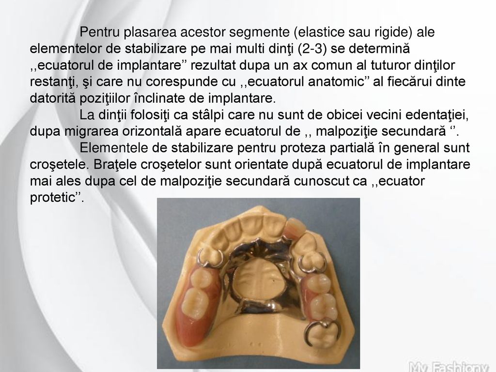 Pentru plasarea acestor segmente (elastice sau rigide) ale elementelor de stabilizare pe mai multi dinţi (2-3) se determină ,,ecuatorul de implantare’’ rezultat dupa un ax comun al tuturor dinţilor restanţi, şi care nu corespunde cu ,,ecuatorul anatomic’’ al fiecărui dinte datorită poziţiilor înclinate de implantare.
