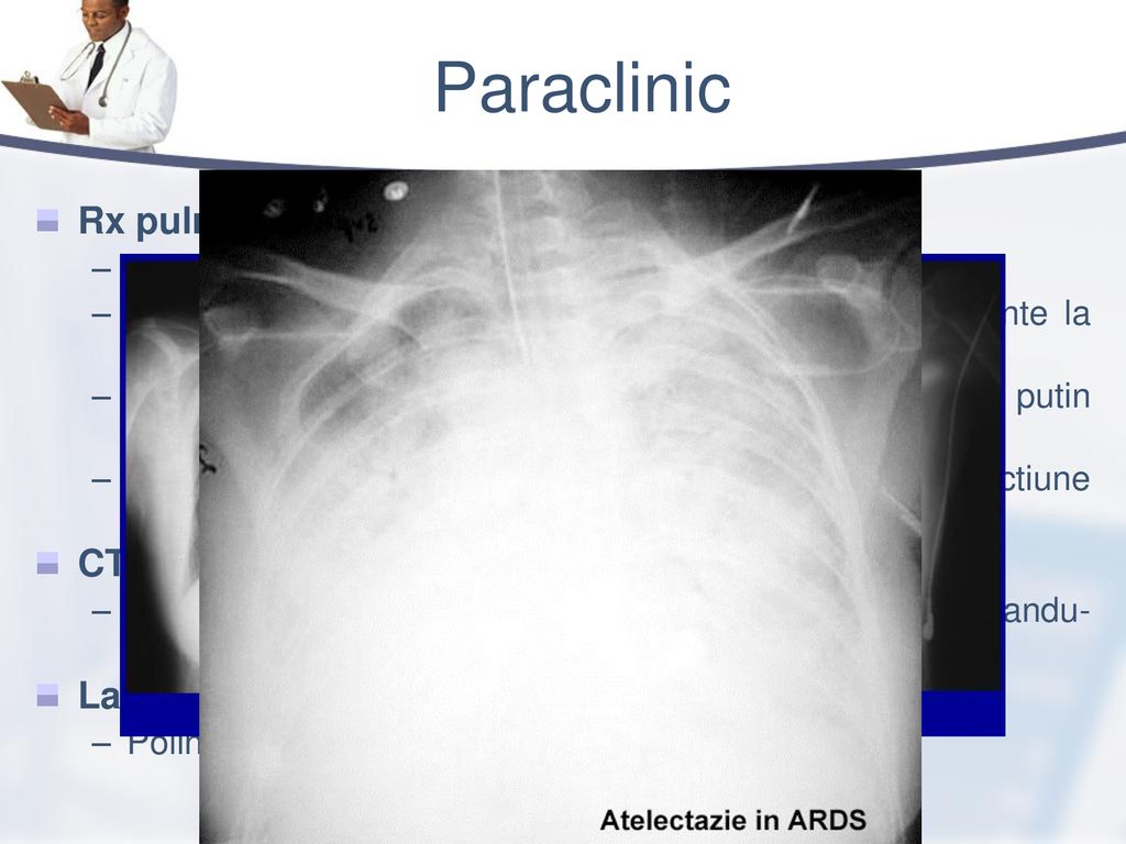 Paraclinic Rx pulmonar: CT pulmonar: Lavaj bronho-alveolar