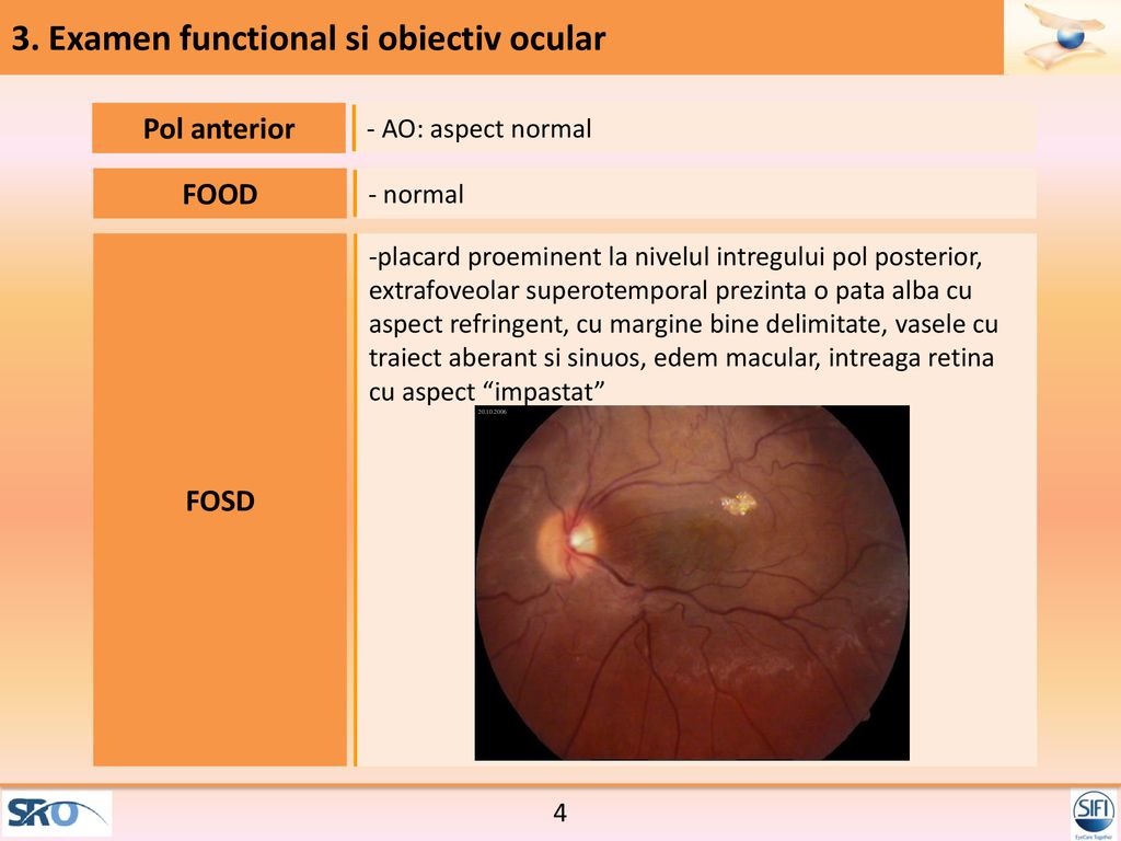 3. Examen functional si obiectiv ocular