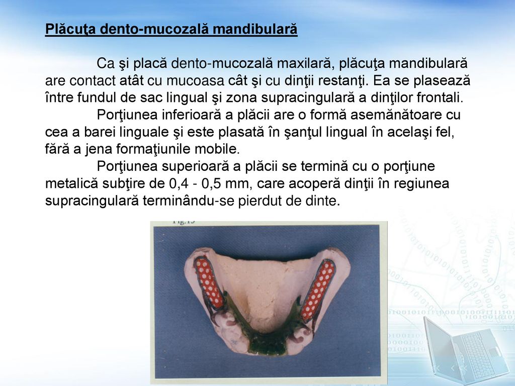 Plăcuţa dento-mucozală mandibulară
