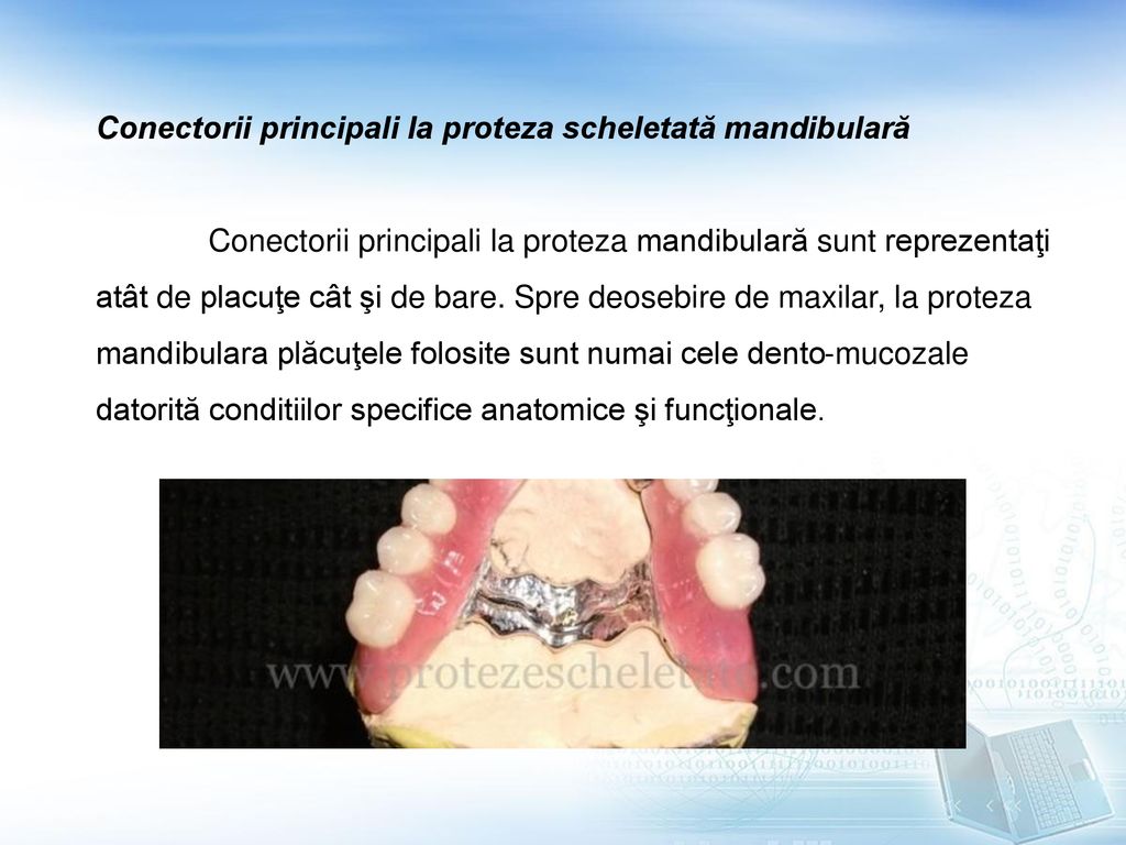 Conectorii principali la proteza scheletată mandibulară