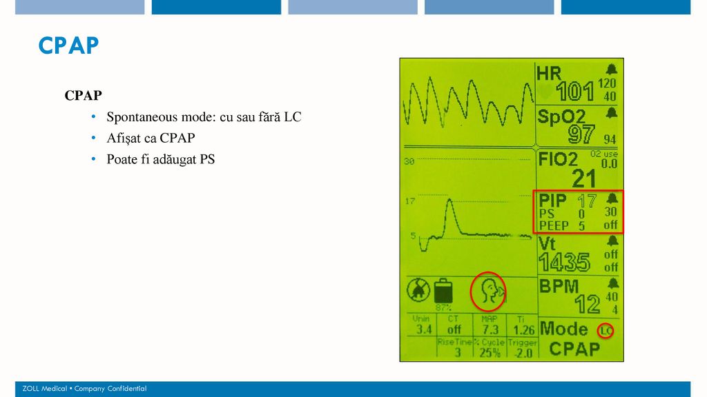 CPAP CPAP Spontaneous mode: cu sau fără LC Afișat ca CPAP